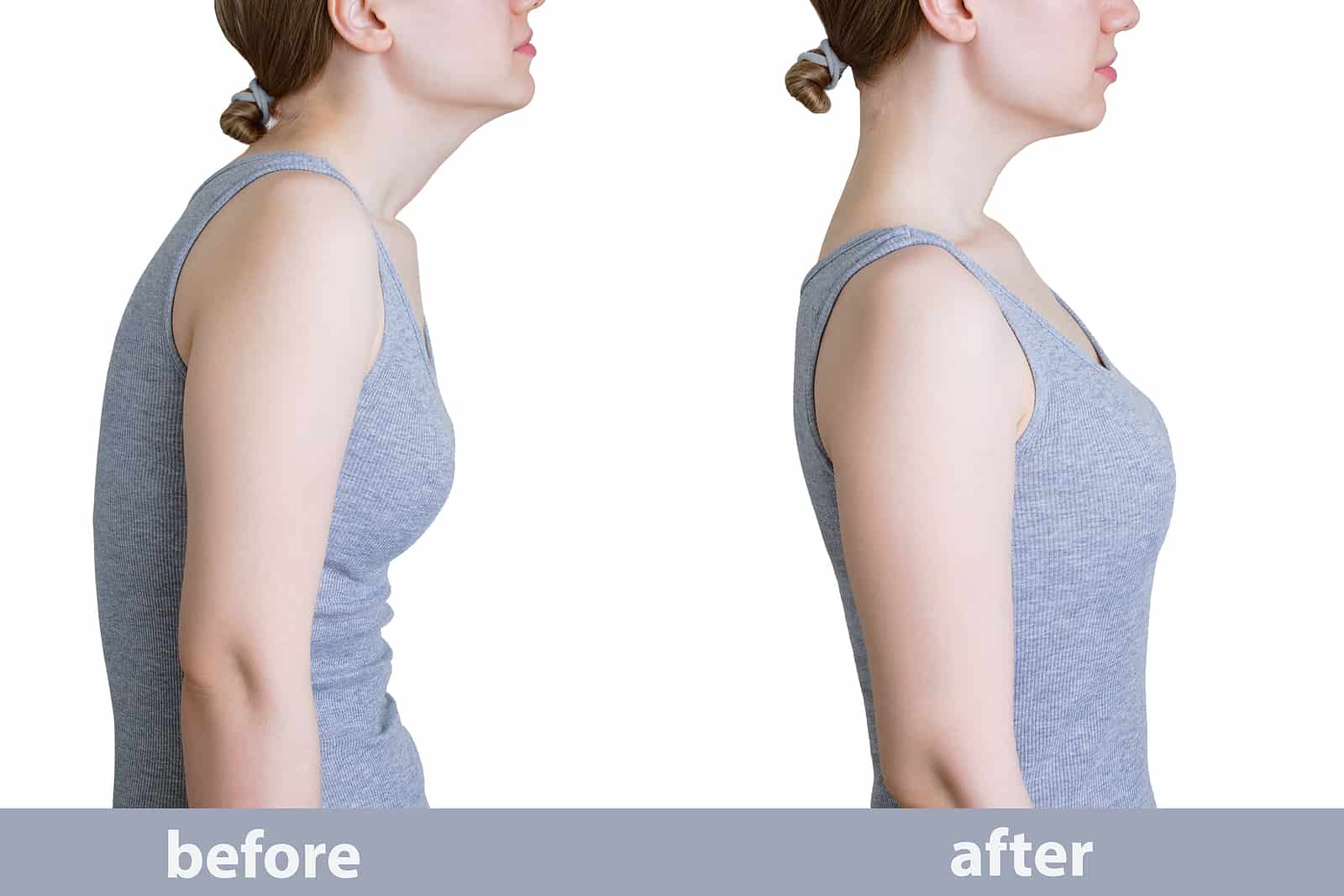 before and after of correct posture